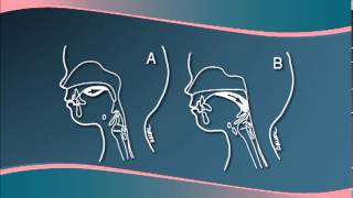 Chapter 3  Understanding Cleft LipPalate Physiology [upl. by Bren155]