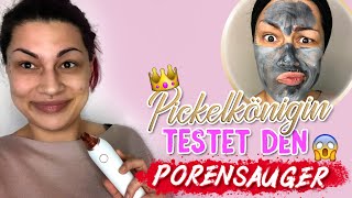 Meine Mitesser Entfernen Routine  Porensauger Erfahrungen  Mitessersauger Review [upl. by Tobie]