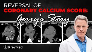 Reversal of Coronary Calcium Score Gerrys Story [upl. by Airelav]