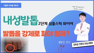 내성발톱 2단계자꾸 재발 하는 내성발톱 이렇게 치료 하세요 피부과전문의 [upl. by Aurore806]