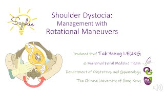 Shoulder Dystocia  Management with Rotational Maneuvers  OBG CUHK [upl. by Lunseth110]