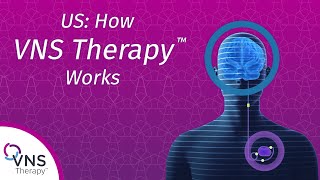 US How VNS Therapy™ Works [upl. by Yblok355]