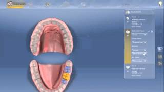 CEREC SW 44 Tutorial 2  Administration Phase [upl. by Nyledam]