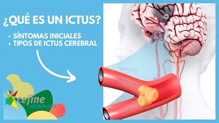 🧠 ¿QUÉ ES UN ACV Y POR QUÉ SE PRODUCE  Síntomas causas e información del INFARTO CEREBRAL o ICTUS [upl. by Jadwiga]