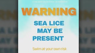 Rashcausing sea lice reported at NJ bay beaches [upl. by Priebe]