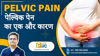 Pelvic Pain का एक और कारण  Explained by Dr Amod Manocha [upl. by Tonl356]