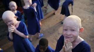 Albino People Hunted In Tanzania [upl. by Mersey]