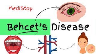 Behcets Disease explained  Signs amp Symptoms Diagnosis Treatment [upl. by Batruk]