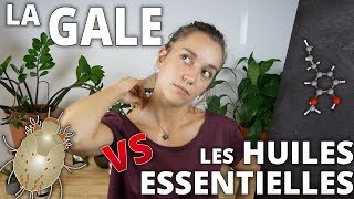 LA GALE  Remède naturel aux huiles essentielles [upl. by Kimble]