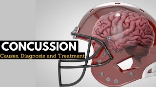 CONCUSSION Causes Signs and Symptoms Diagnosis and Treatment [upl. by Aneg]