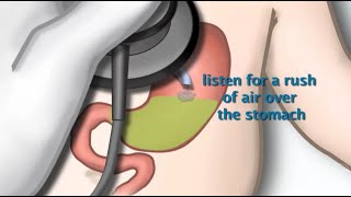 Nasogastric Tube Placement by S Hamilton  OPENPediatrics [upl. by Isadore]