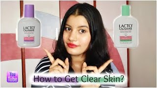 Get Clear Skin with Lacto Calamine Lotion  Remove Acne Scars amp Pigmentation Easily  Riya Beauty [upl. by Marlyn]