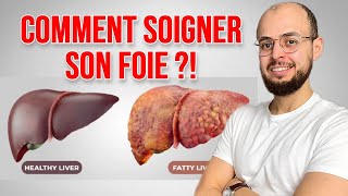 Comment soigner le FOIE GRAS Stéatose hépatique [upl. by Alekram]