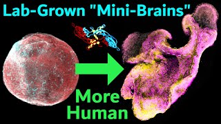 New Technique Makes Brain Organoids More Like Real Human Brains Expanded Neuroepithelium Organoids [upl. by Dari]