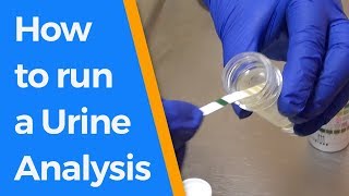 How to run a Urine Analysis [upl. by Assenat]