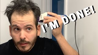 BALDING AT 30  Shaving Off My Balding Hair  Live 17 [upl. by Alyssa]