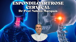 ESPONDILOARTROSE CERVICAL Dr Prof Nelson Marques [upl. by Indihar]