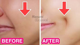 How To Get Dimples Fast amp Naturally Simple Facial Exercises to get Dimples without Surgery [upl. by Sundin307]