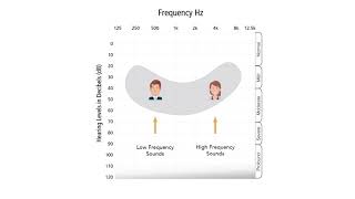 Understanding an Audiogram [upl. by Dace]