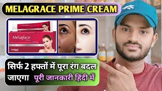 Melagrace prime cream use dose benefits and side effect Full review in hindi [upl. by Robinia]