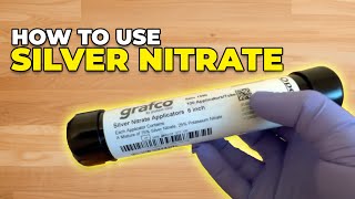 How to use silver nitrate [upl. by Tada]