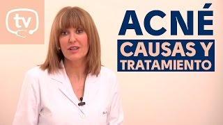 Causas y tratamiento del acné [upl. by Lissa613]