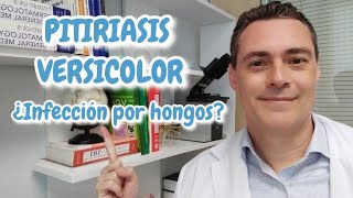 Dermatólogo explica la pitiriasis versicolor Manchas por hongos en la piel [upl. by Aivlis]