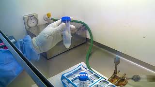 10 Demonstration of processing of sputum specimen for culture for diagnosis of tuberculosis [upl. by Huber]