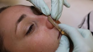 Dermaplaning facial resets your face with scalpels and acid  Glam Lab [upl. by Auqkinahs]