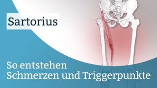 Sartorius Schmerzen Triggerpunkte und deren Aktivierung [upl. by Einohtna]