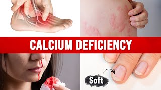 Best Home Test for a CALCIUM DEFICIENCY [upl. by Misa789]