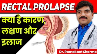 Rectal Prolapse Causes Symptoms and Treatmentdrramakantsharma7 [upl. by Ja]