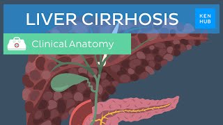 Liver cirrhosis Definition pathology diagnosis treatment and prevention  Kenhub [upl. by Gnes]