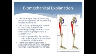 Mobilization to correct an Anterior Innominate rotation of the pelvis Physical Therapy [upl. by Eki636]