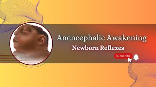 Exploring Reflexes in Babies with Anencephaly [upl. by Sile496]