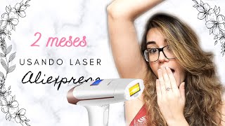 Resultado 2 meses usando depilador a laser do Aliexpress Lescolton [upl. by Rosio]