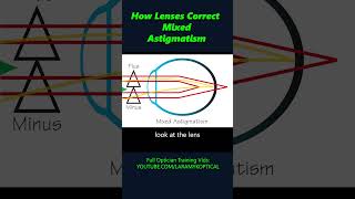 How lenses correct Mixed Astigmatism [upl. by Wendi279]