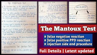 Mantoux Test  Mantoux Test Positive amp Negative results  Mantoux Test Procedure [upl. by Duax]