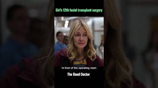 Girls 12th facial transplant surgerythegooddoctor storytelling [upl. by Sabine]