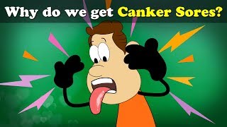 Why do we get Canker Sores ulcers  more videos  aumsum kids science education children [upl. by Labana]