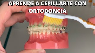 ¿CÓMO CEPILLARSE LOS DIENTES CORRECTAMENTE CON ORTODONCIA HILO DENTAL Y CEPILLADO CON BRACKETS [upl. by Anitsrihc939]