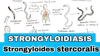 Strongyloidiasis  Life cycle Symptoms Treatment  Strongyloides stercoralis  Bio science [upl. by Rednasxela]