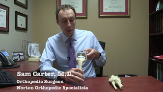 What is a partial knee replacement [upl. by Ternan]