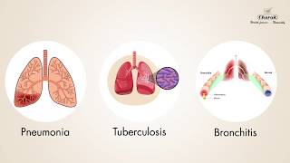 Chest Infections Symptoms and Treatment by Dr Mahashur [upl. by Salomi]