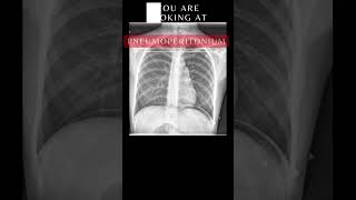 Can You Pass This Quiz Questions and Answers  10 Essential Chest Xrays xray respiratory [upl. by Krista873]