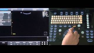 Chison ECO3 Ultrasound Machine Video Training [upl. by Calore]