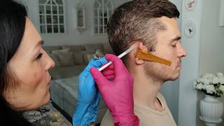 ASMR Skin Examination Behind The Ear [upl. by Virgilio]