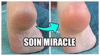 Des PIEDS de bébé en 1 min chrono 👣LOVASKIN [upl. by Anahpos181]