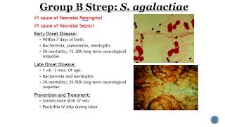 Group B Streptococcus GBS [upl. by Maltzman]