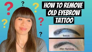 How to Remove Old and Dark Eyebrow Tattoo [upl. by Enehs]